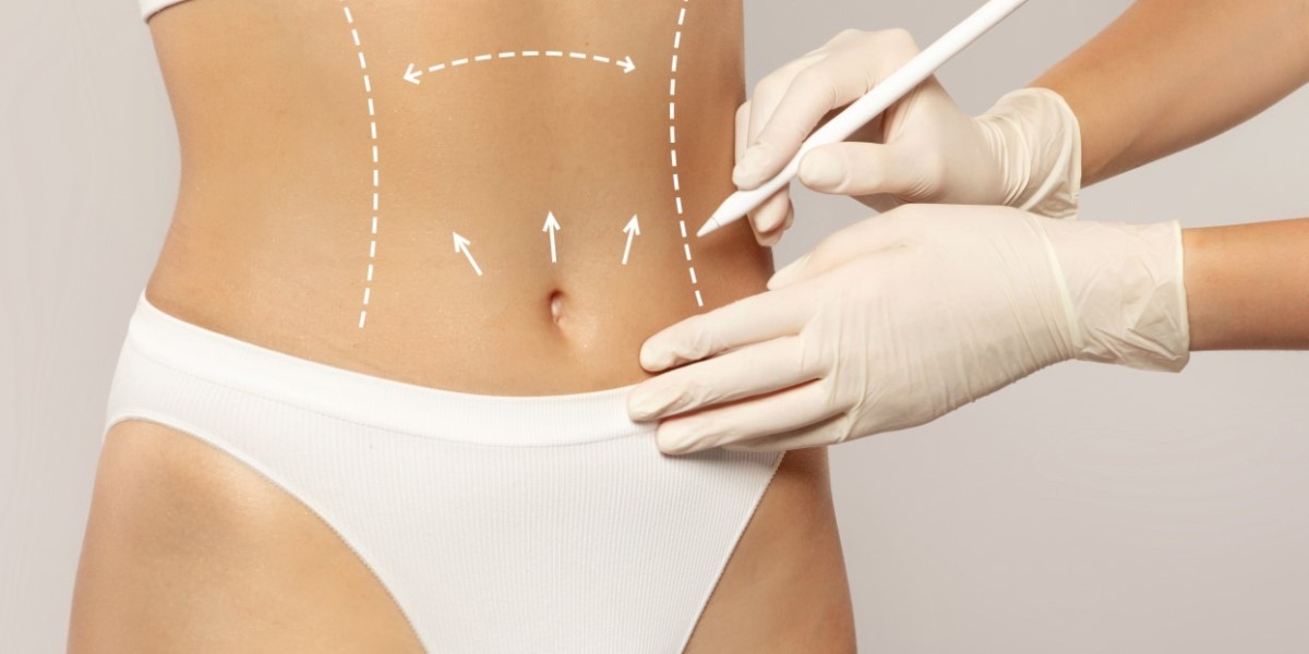Liposuction in Dubai: A Precision Approach to Body Contouring