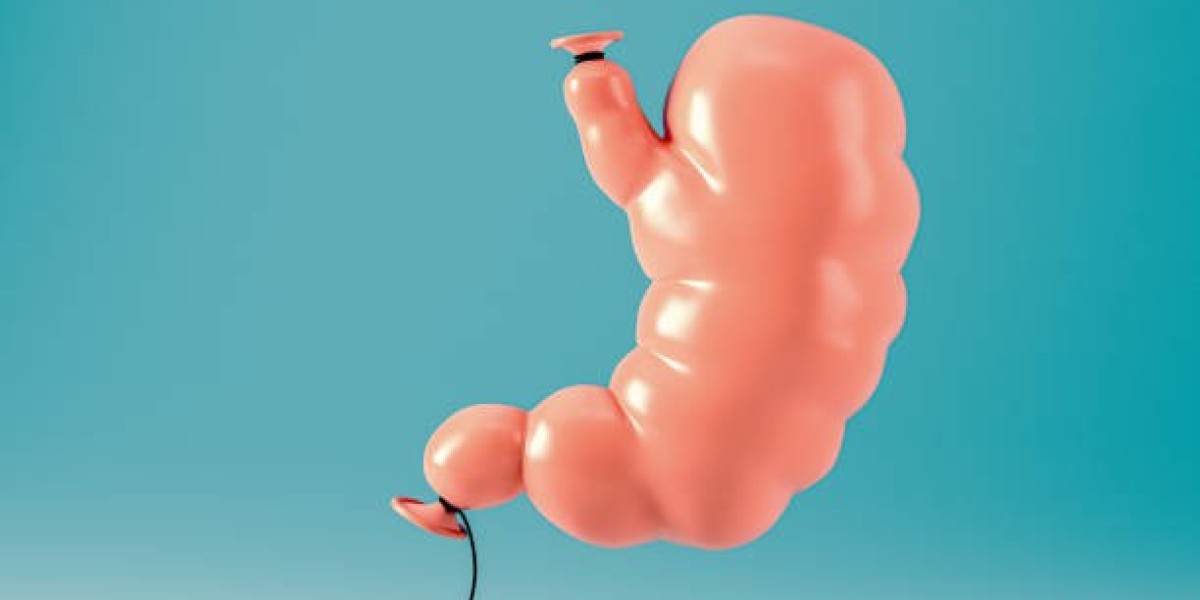 Get Started with Gastric Balloon in Riyadh for  <br>                            Weight Loss