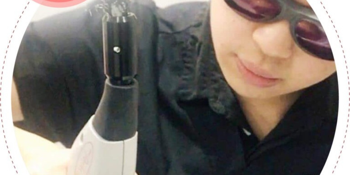 Achieve a Slimmer Face: Dr Sin Yong’s Non-Invasive Treatments for Overfilled Cheeks