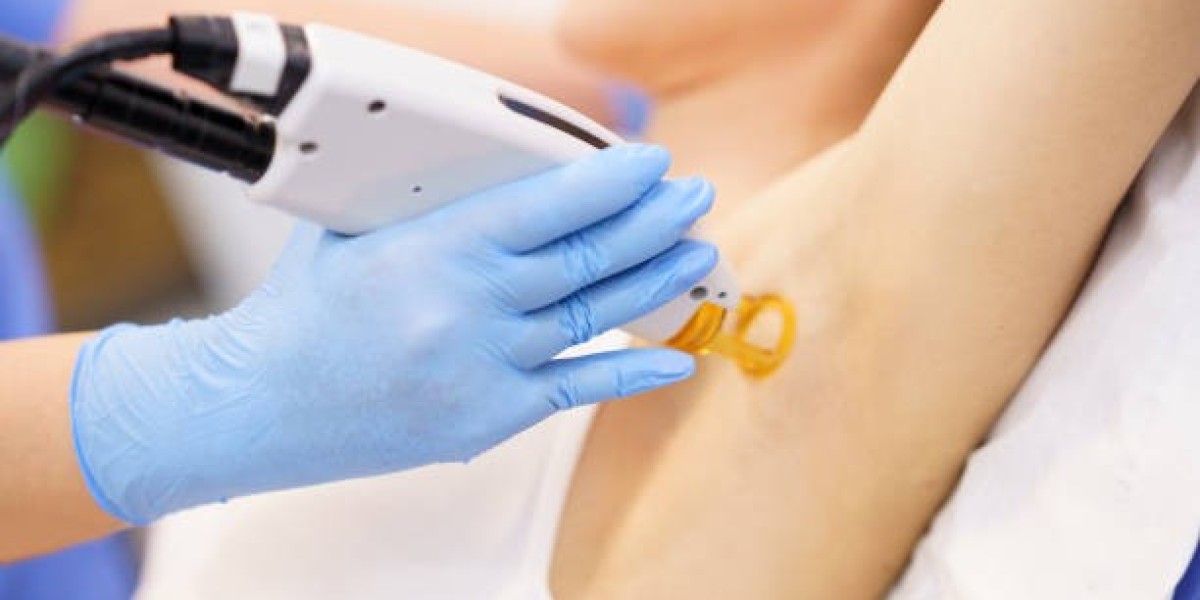 Full Back Laser in Riyadh – Costs and Benefits