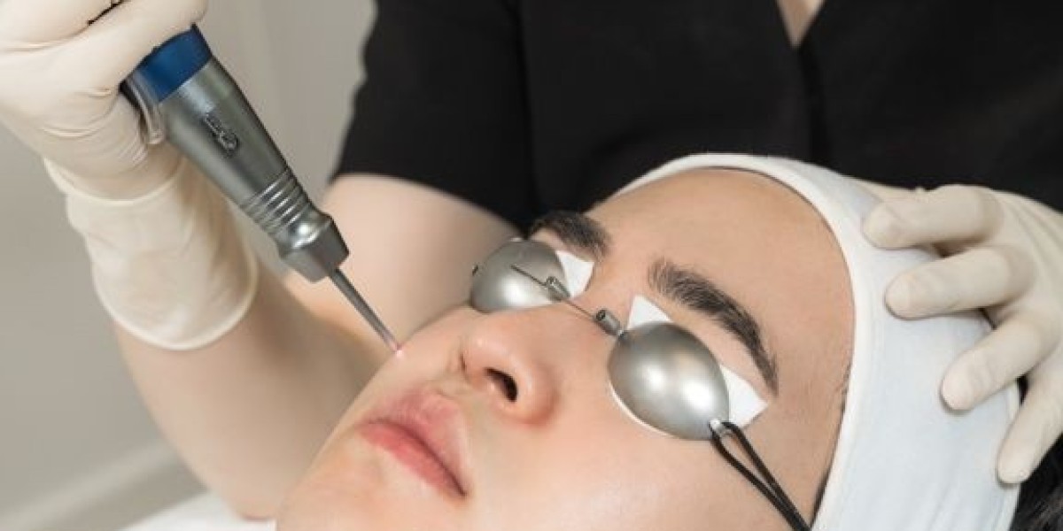 Ditch the Razor: Laser Hair Removal in Riyadh