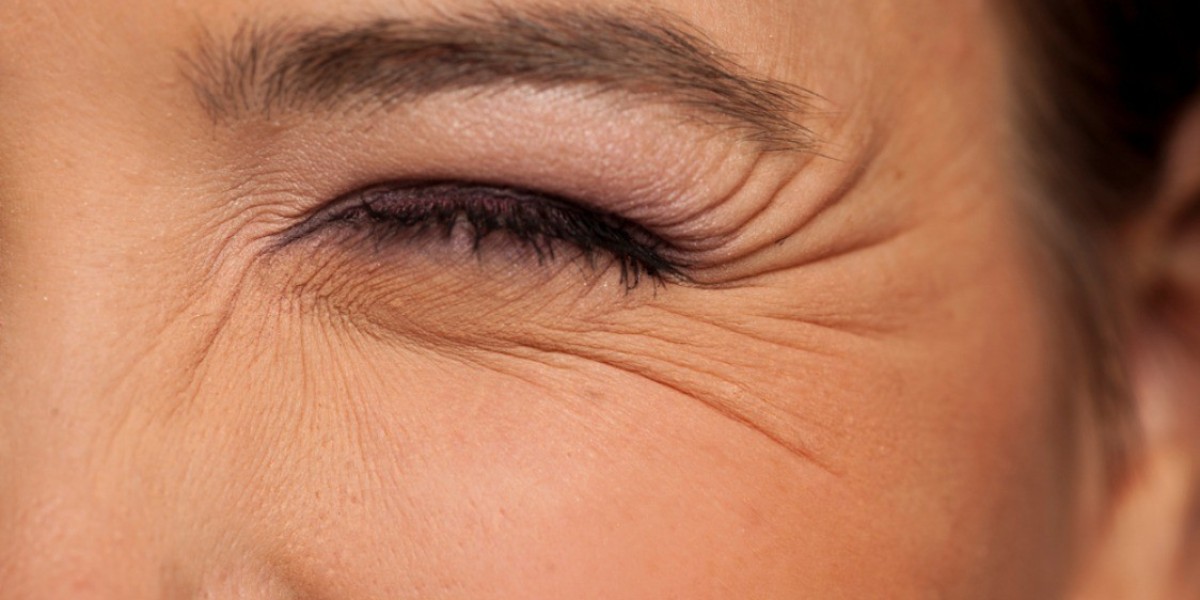 RF and Laser Skin Tightening for Wrinkles in Riyadh
