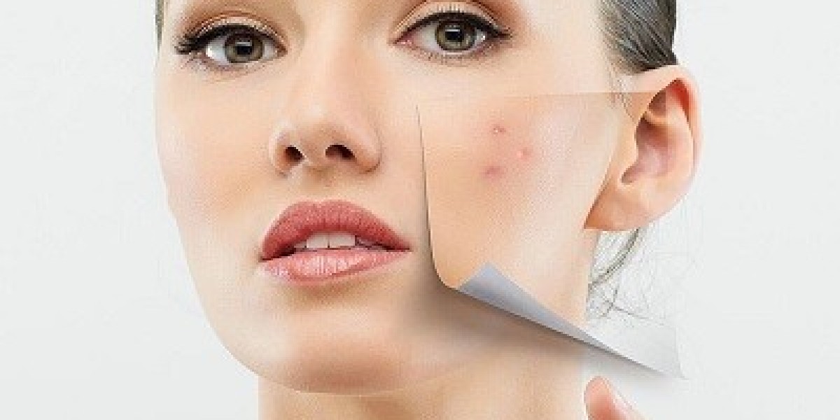 Are acne scar removal treatments painful?
