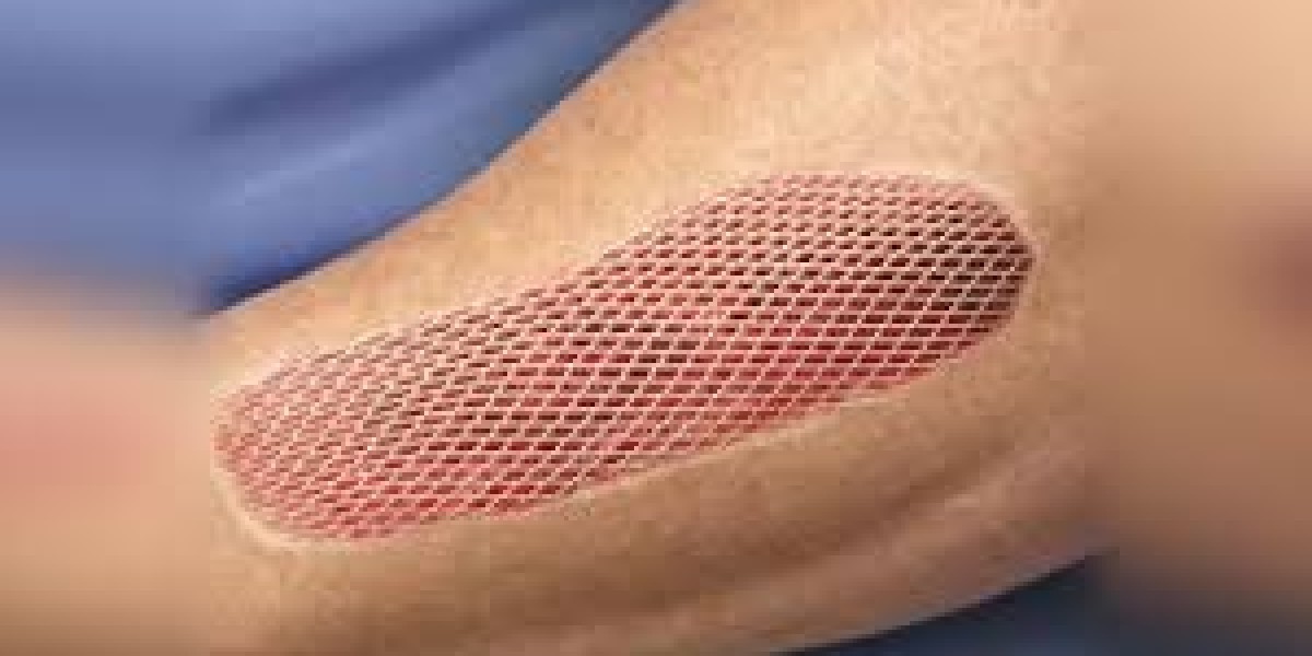 Skin replacement market drivers: Identifying key factors fueling demand for advanced skin replacement technologies world