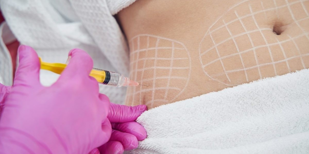 Fat Melting Injections for Face Contouring in Riyadh