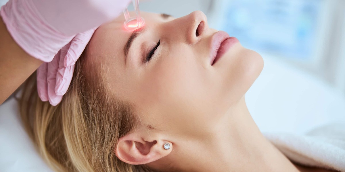CO2 Laser for Hyperpigmentation: Riyadh Treatments Reviewed
