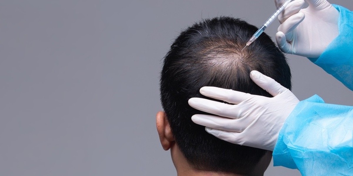 Best Time to Start PRP Hair Treatment in Riyadh