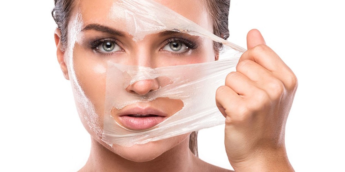 Which Chemical Peel is Best for You in Riyadh?