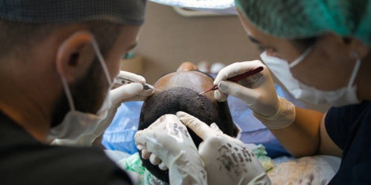 Why Are Hair Transplants in Dubai Expensive? Understanding the Factors
