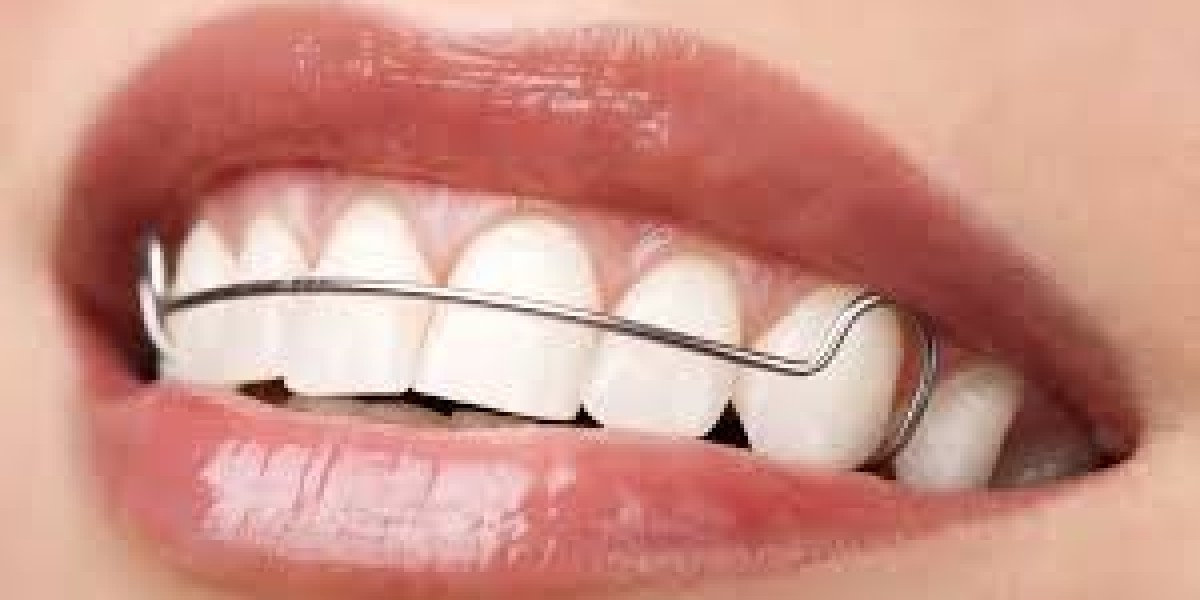 Orthodontic Retainers Market challenges and opportunities presented by emerging digital orthodontic technologies