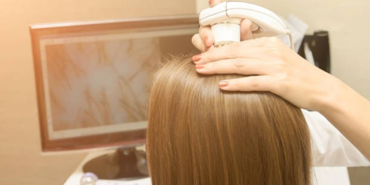 Exosomes Therapy for Hair Loss in Riyadh – How It Works and Why It’s Effective