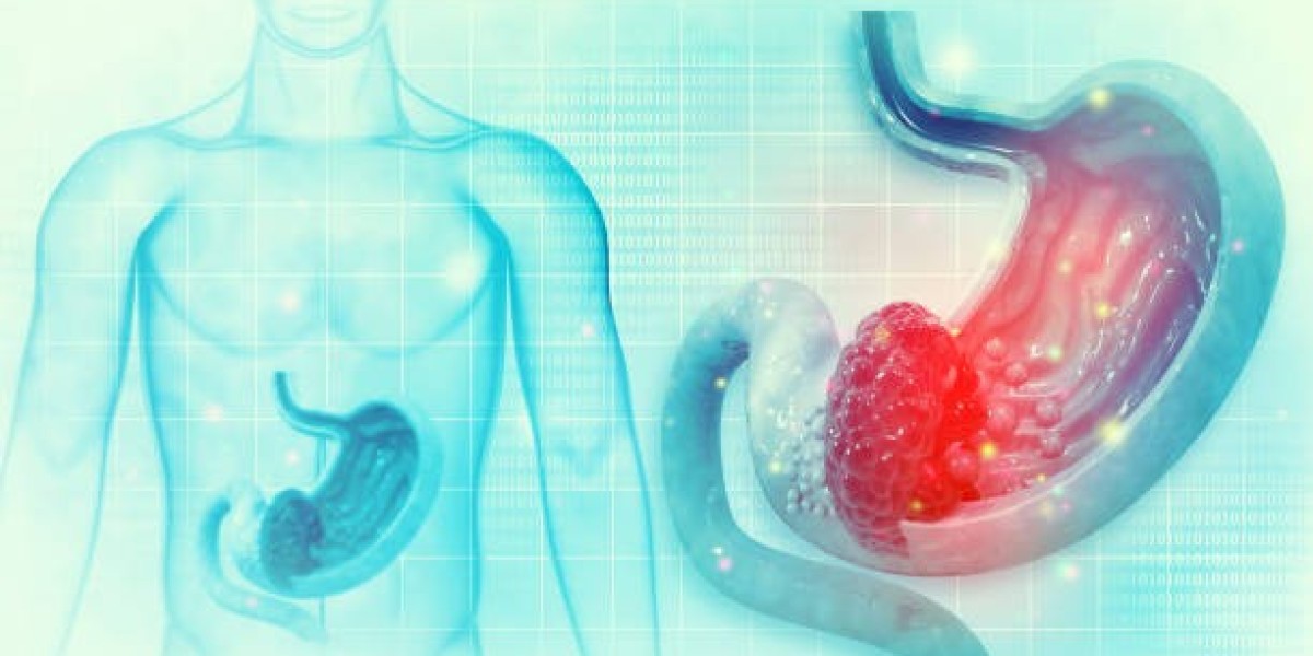 The Ultimate Guide to Gastric Balloon in Riyadh
