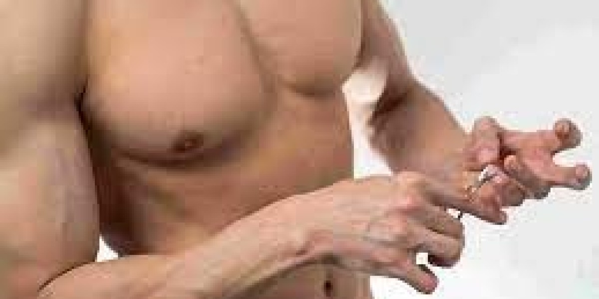 Dubai Gynecomastia Surgery Costs for Early Symptoms