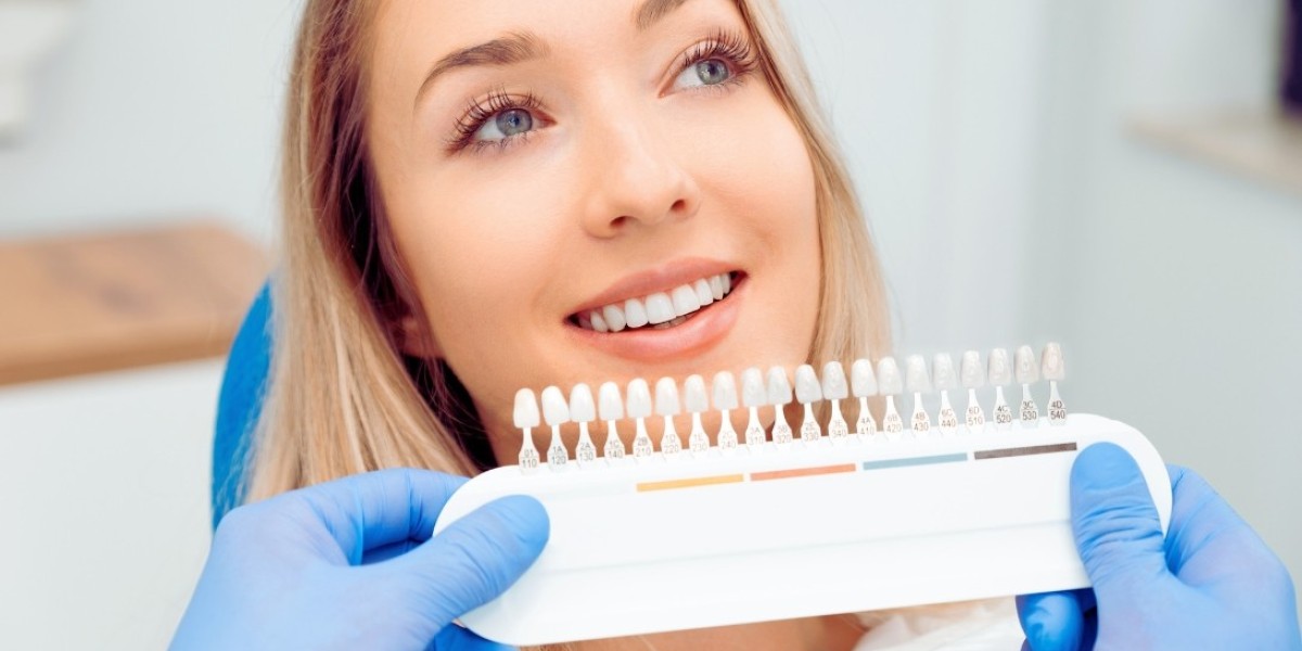 Minimalist Dentistry: How Non-Prep Veneers Fit Modern Lifestyles