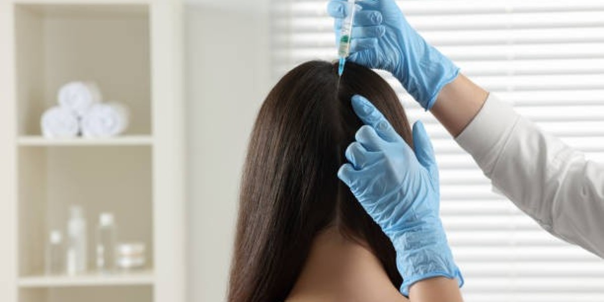 Discover the Power of Exosomes Therapy for Hair Loss in Riyadh
