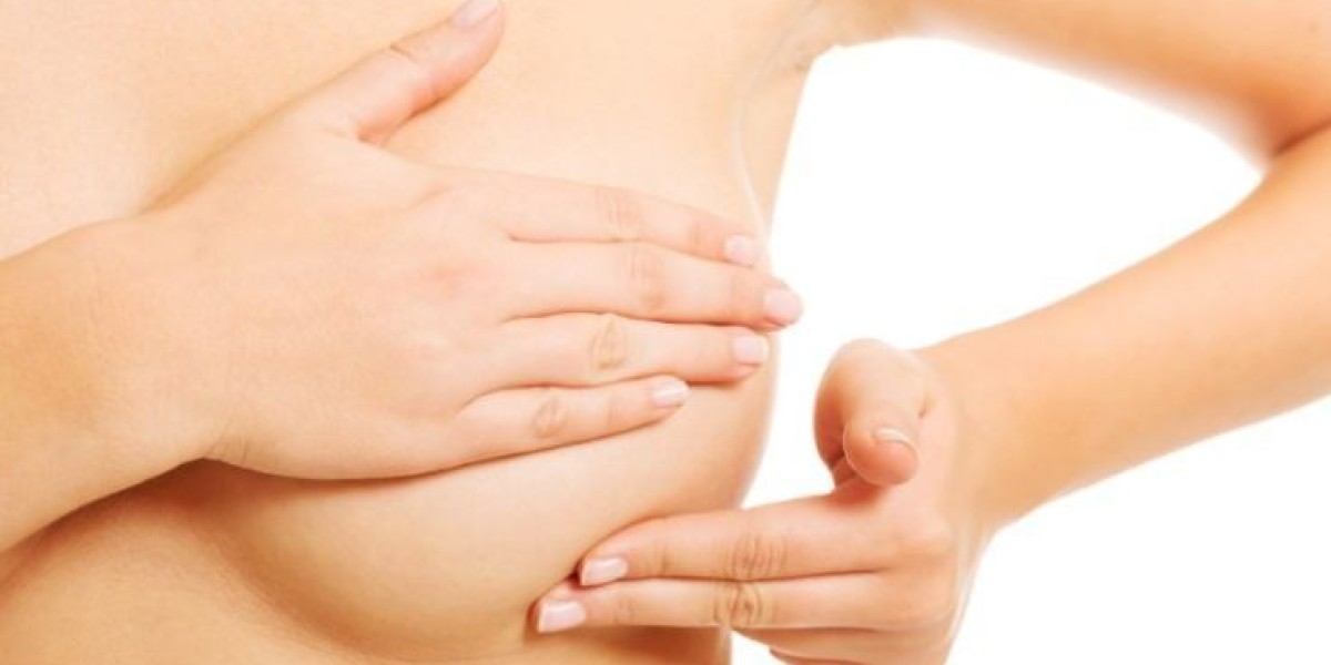 Breast Cysts Treatment in Riyadh: What Works Bes