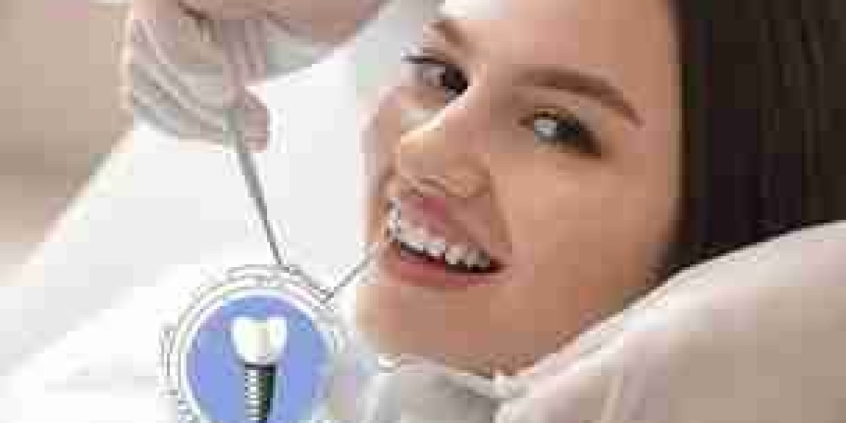 Restore Your Natural Smile with Advanced Implant Technology