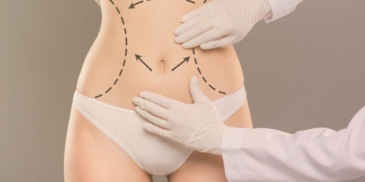 Liposuction Techniques That Deliver the Best Results Every Time