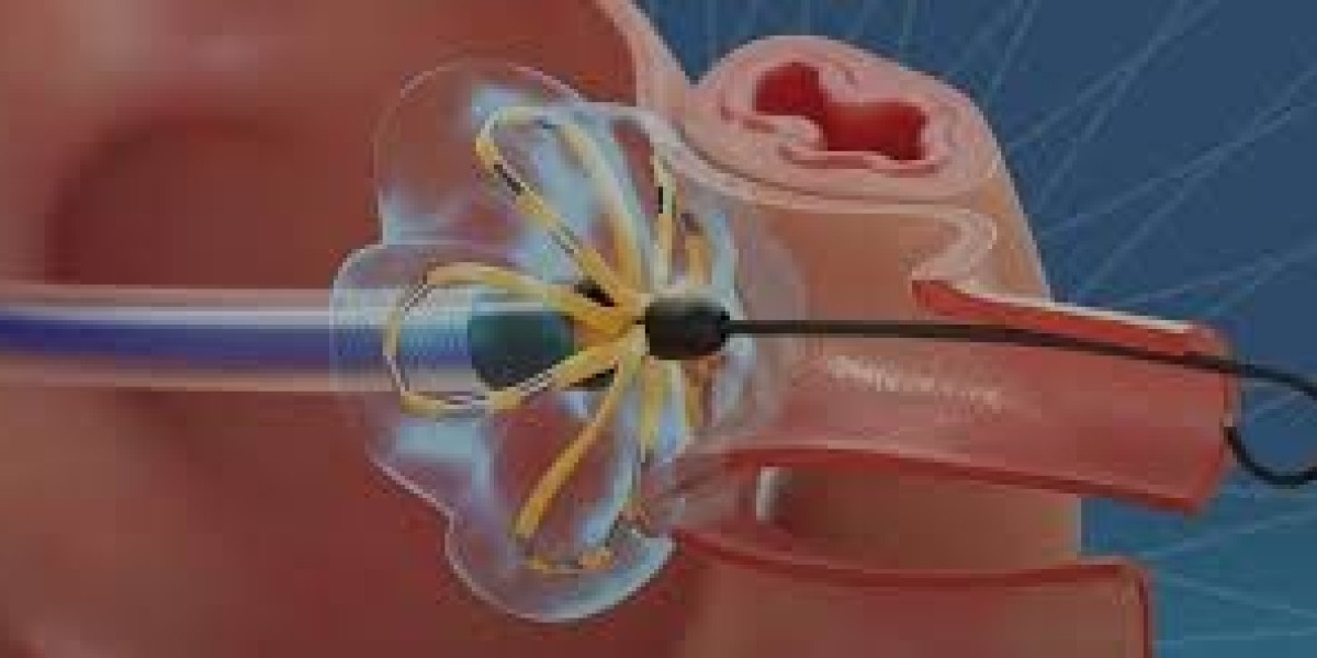 Atrial Fibrillation Device Market: Winning Strategies for Global Market Success