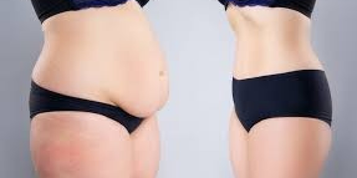 Transforming Your Body and Health: A Guide to Modern Body Shaping and Wellness