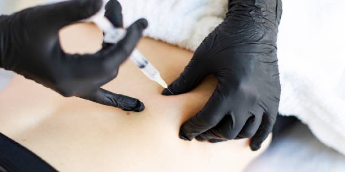 Best Areas for Body Fillers in Riyadh