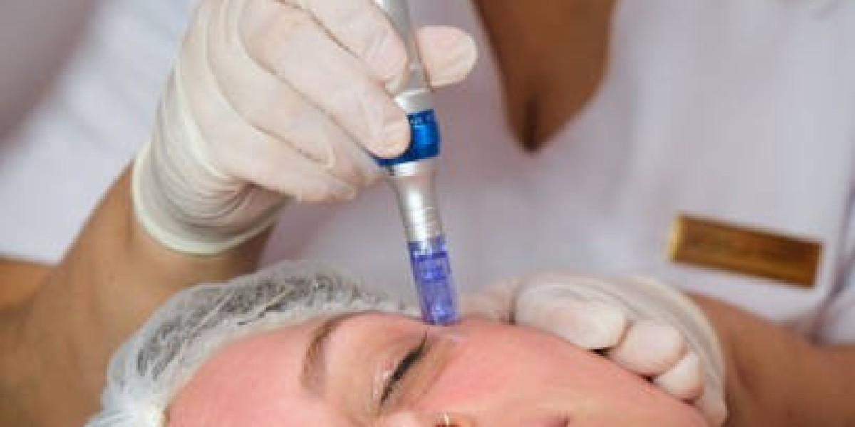 Derma Pen: Collagen Boost Made Easy