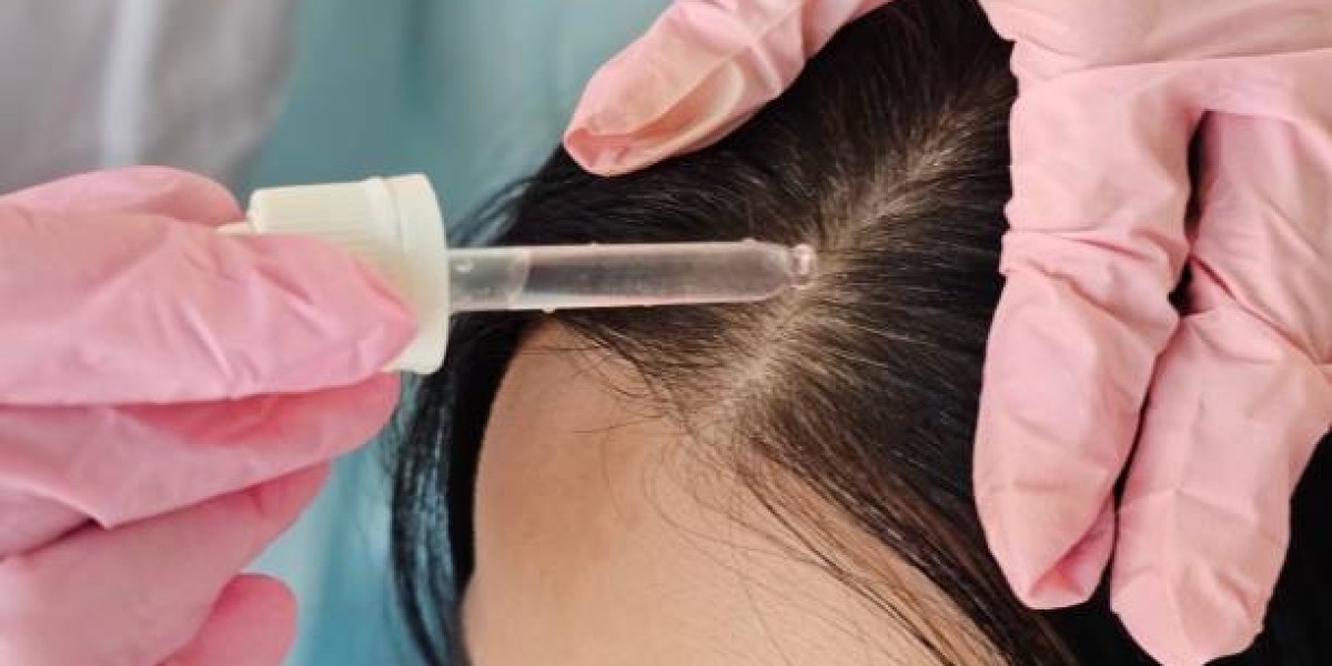 Find Out Why Exosomes Therapy is the Future of Hair Loss Treatment in Riyadh