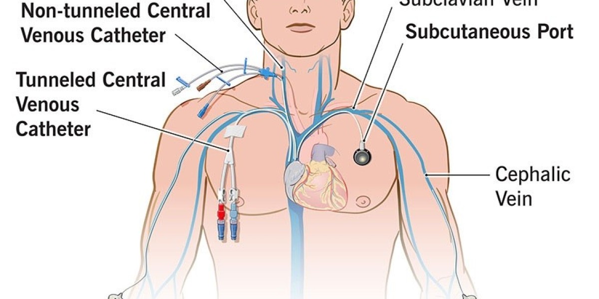 Parenteral Nutrition Market Increasing Demand in Oncology Support Care