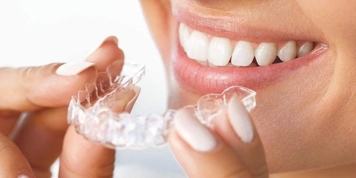 Planning Your Smile Invisalign Braces Treatment Cost Insights