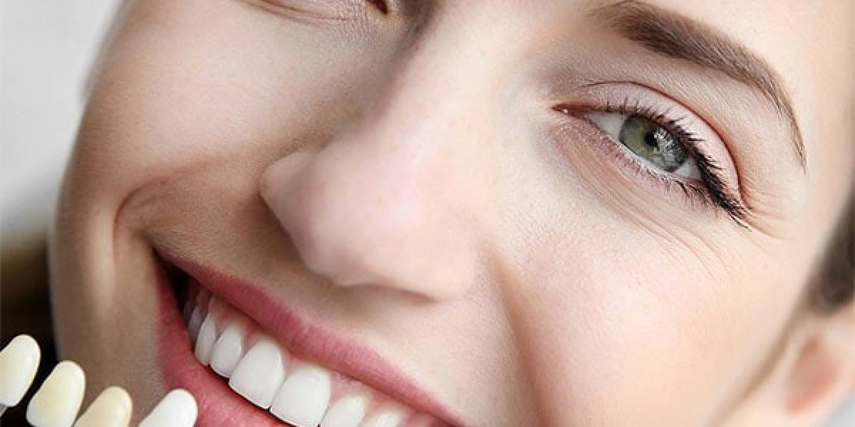 Top Questions to Ask Before Booking Cosmetic Dental Work