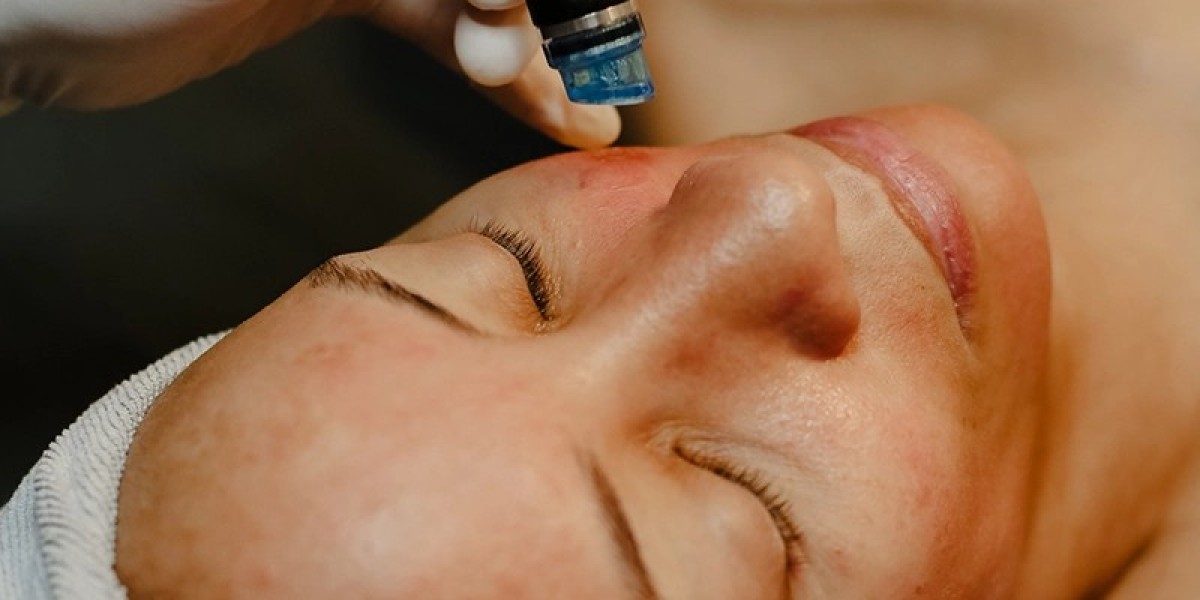 Is HydraFacial Worth It? Here’s the Truth