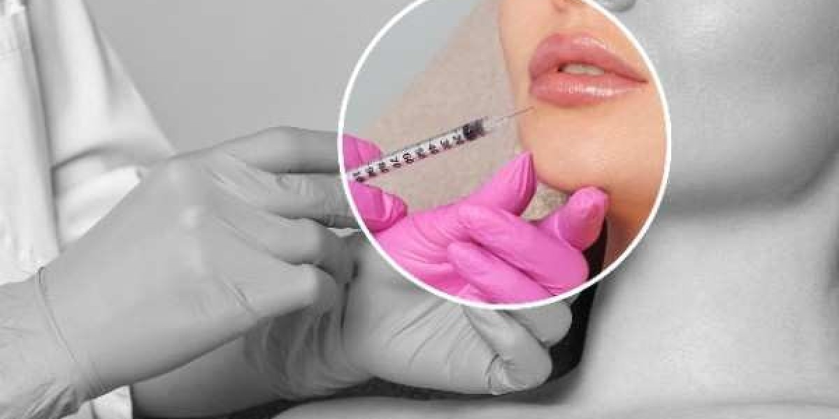Expert Lip Fillers for Your Perfect Pout from Our Private Dentist