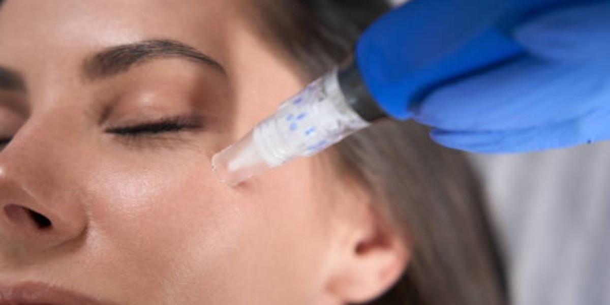From Wrinkles to Scars: How Derma Pen Can Help