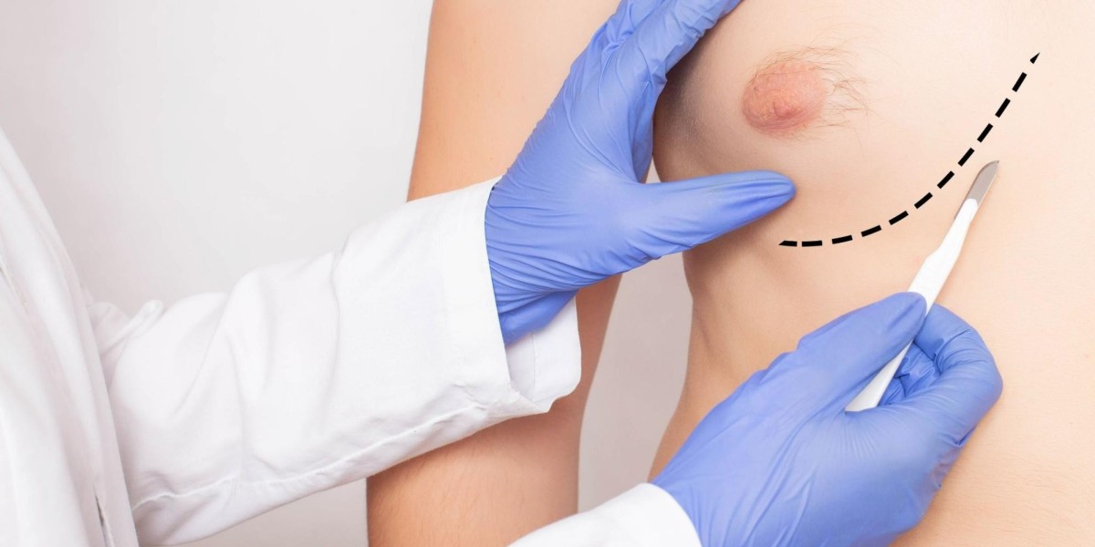Understanding the Causes of Male Breast Enlargement and When to Consider Surgery
