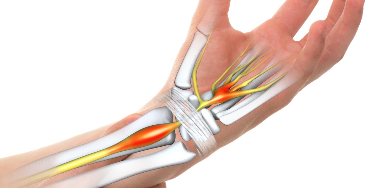 Why Your Hands and Wrists Hurt: Top Causes Revealed