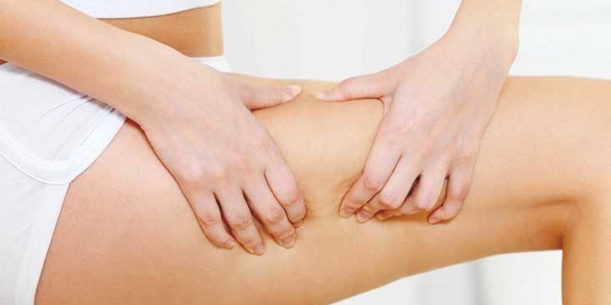 Cellulite Removal: Ideal Options for Every Budget