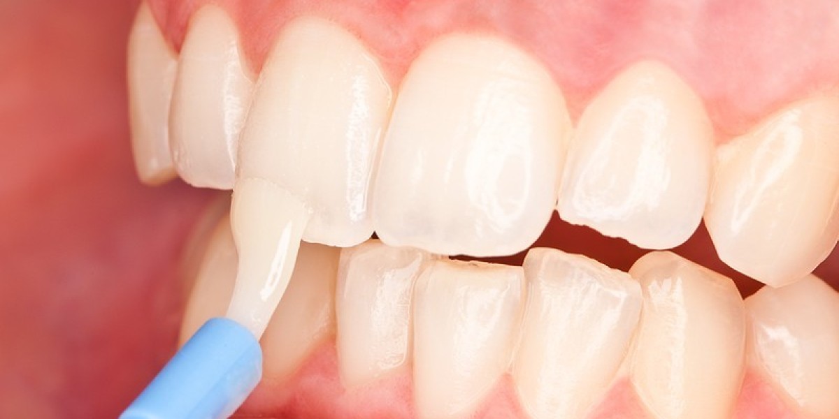 Teeth Desensitizer Market Experiences Transformation with E-Commerce Growth and Technological Integration