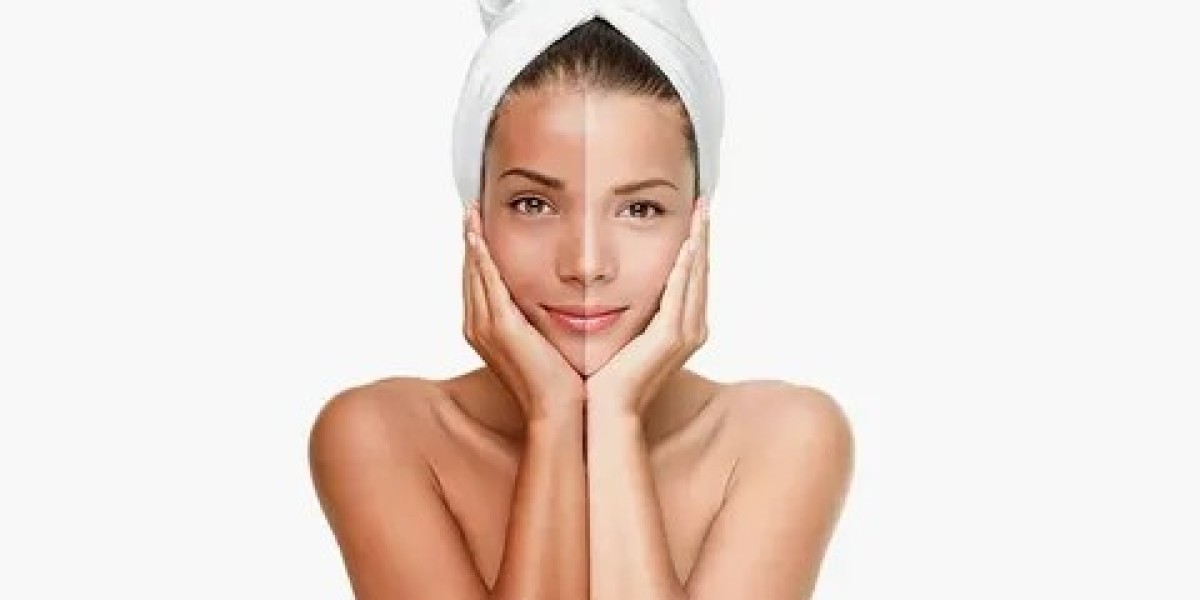 Skin Whitening in Islamabad for Professionals