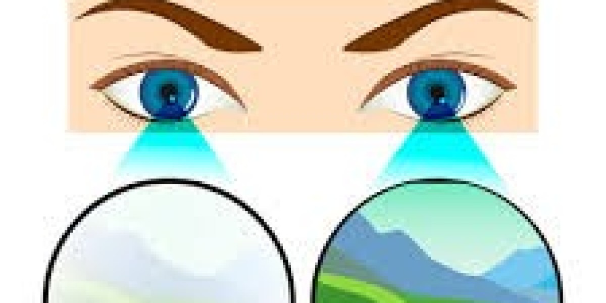 Global Amblyopia Market Outlook: Trends, Growth & Forecast 2022–2032