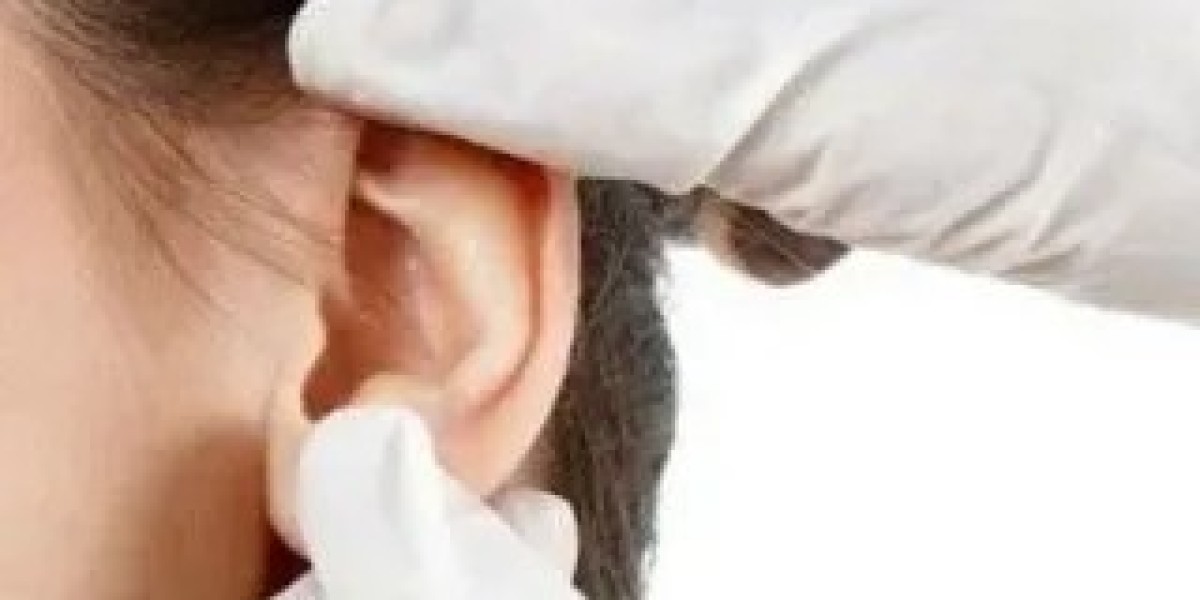 Choosing Local or General Anesthesia for Ear Reshaping in Islamabad