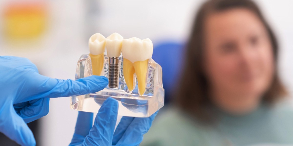 Zirconia vs. Titanium Implants: Which Is Best?