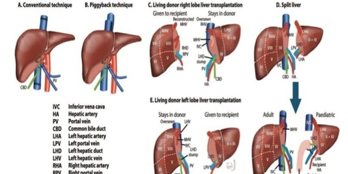 Best Liver Surgeon in Bangalore for Laparoscopic & GI Surgery