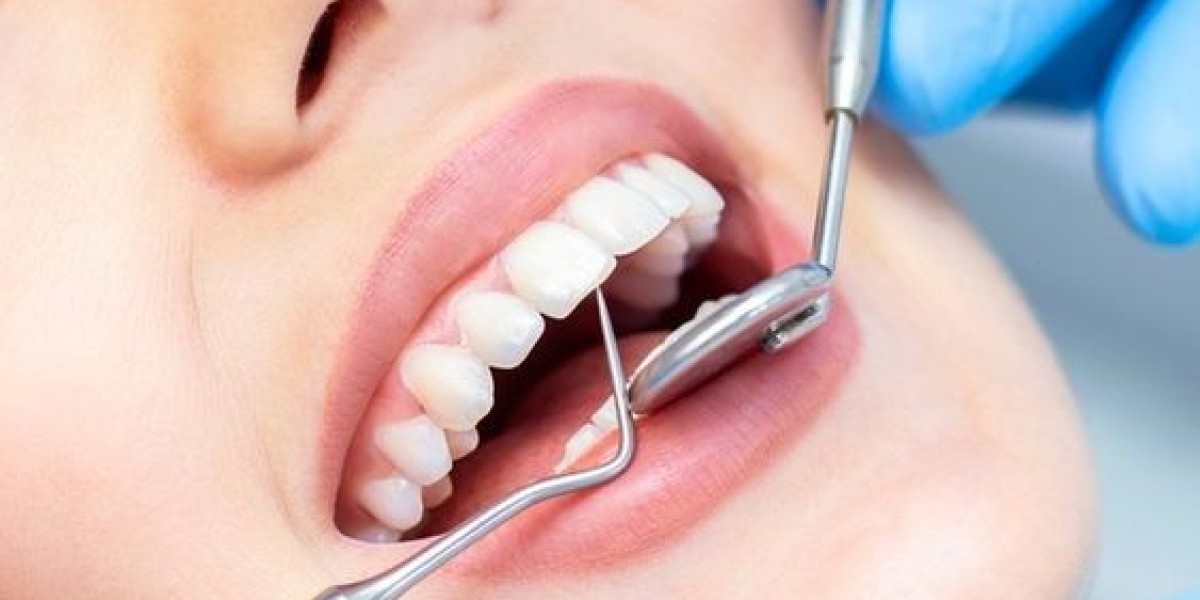 Trám răng không lấy tủy có sao không? Giải đáp từ chuyên gia nha khoa