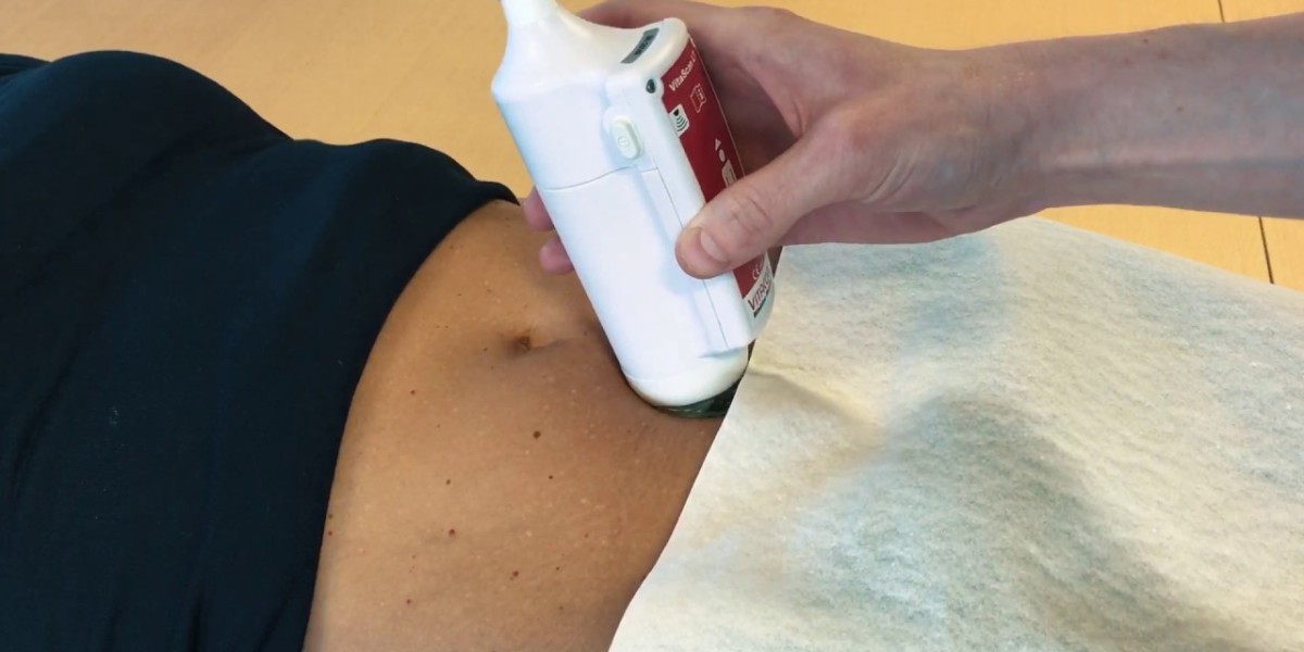 Portable Ultrasound Bladder Scanner Market Innovations Transforming Healthcare Approaches to Bladder Health
