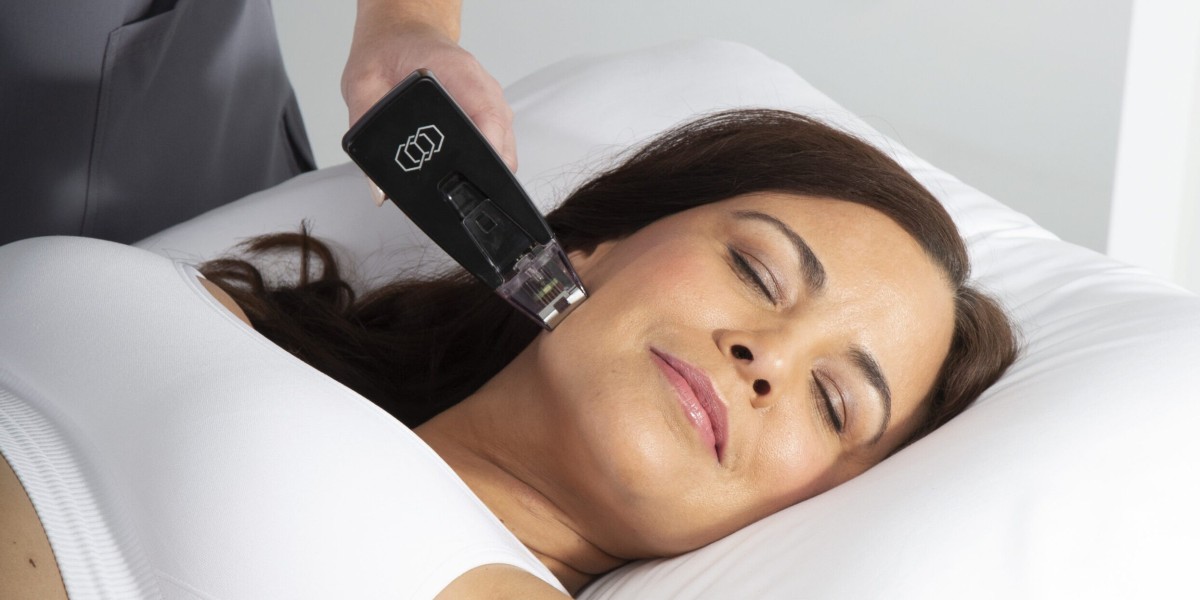 Morpheus8 Treatment for Snatched Skin Without Downtime