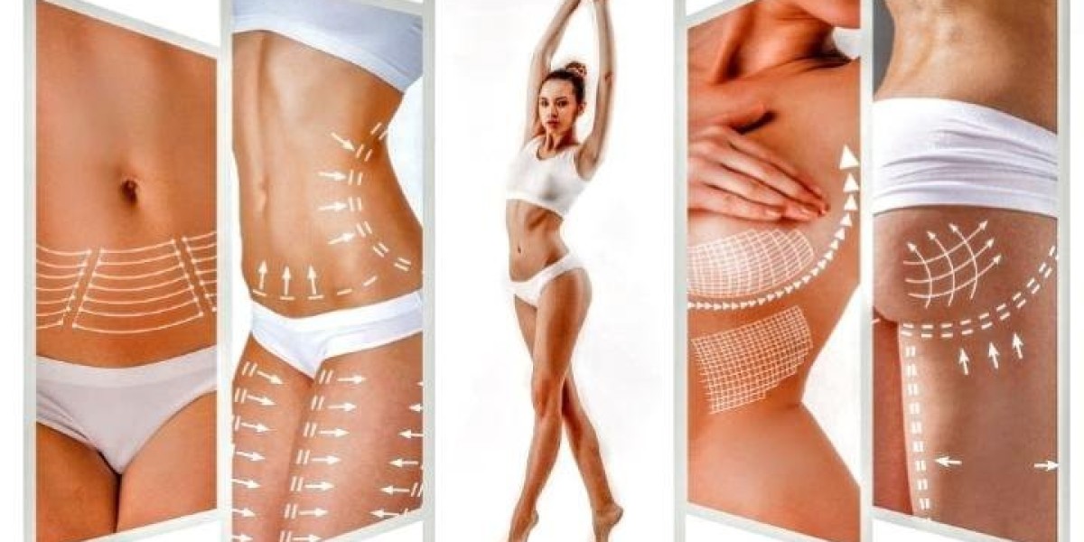 Minimizing Swelling After Body Contouring Treatment in Islamabad