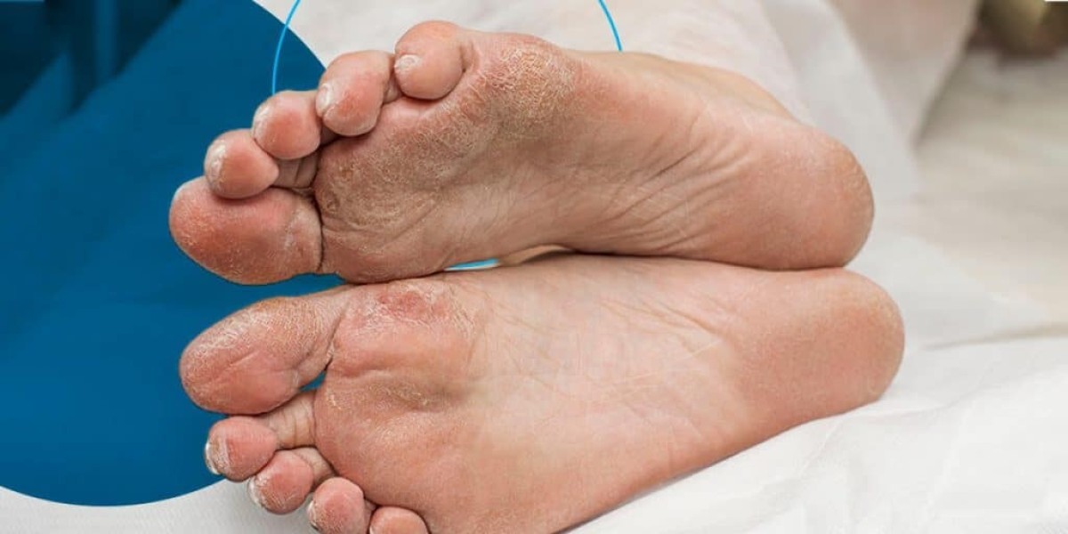 Discover the Power of Diabetic Foot Care at Home in Dubai