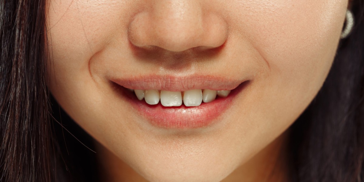 Does Insurance Cover Crooked Teeth Treatment? Find Out Here