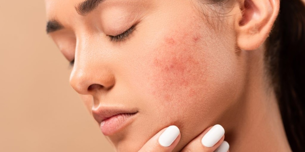 Top Dermatologist for Clear, Glowing Skin