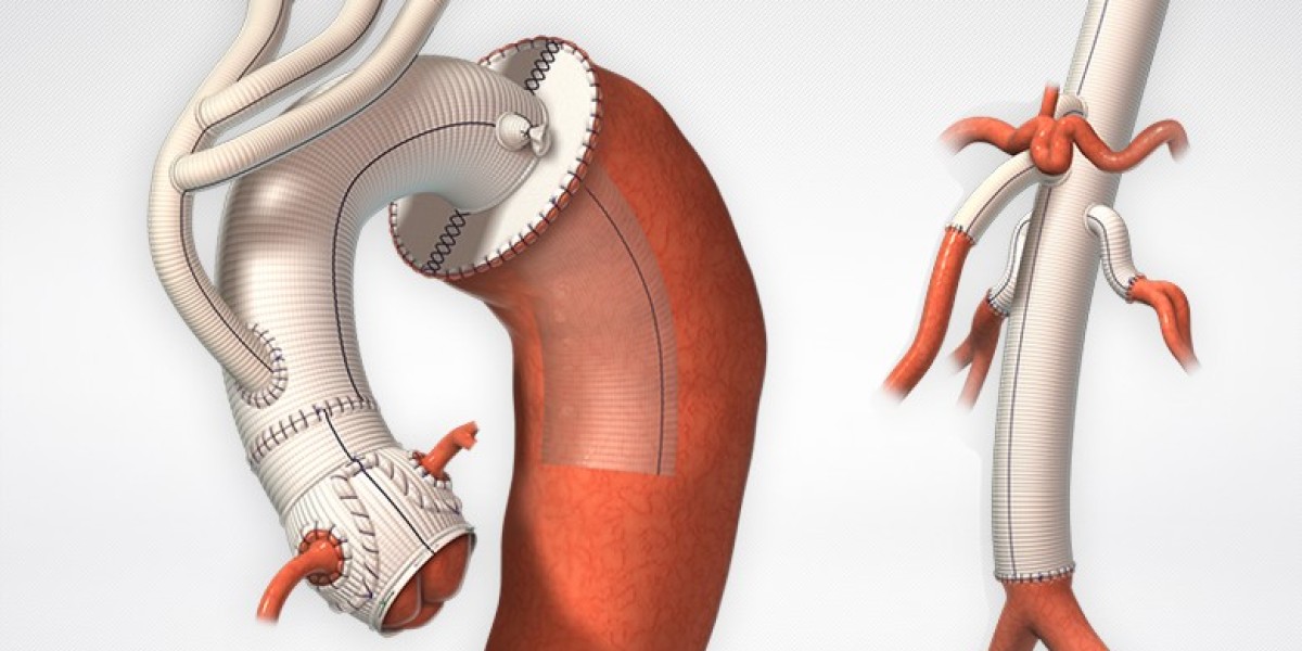 Understanding Vascular Patches Market Dynamics: Growth Drivers, Challenges, Innovations, and Regional Trends